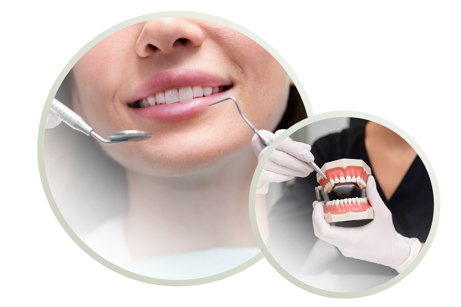 Implantes Dentários