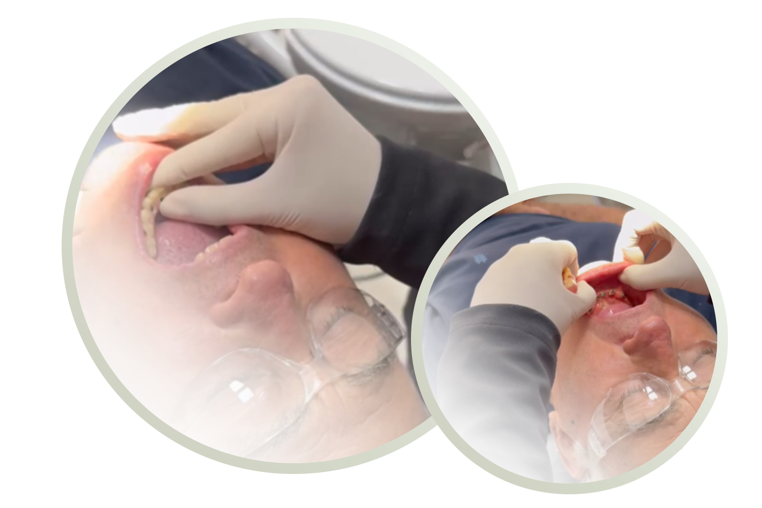 Próteses Dentárias