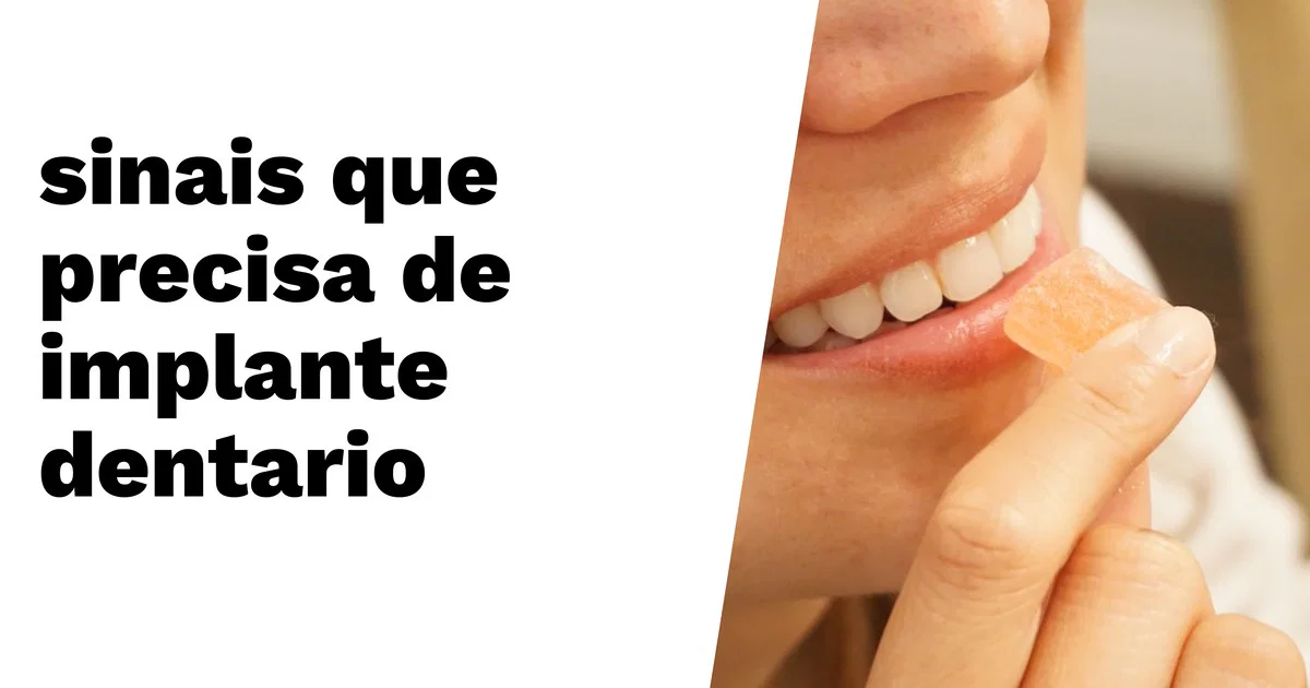Uma pessoa sorrindo e segurando uma bala de goma perto dos dentes, com texto em português sobre sinais de que implantes dentários são necessários.